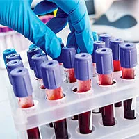Phát hiện cholesterol "xấu xí" vô cùng đáng sợ