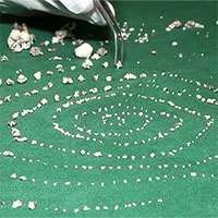 Tại sao bé 7 tuổi có đến 526 chiếc răng?