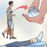 Cách sơ cứu người bị bong gân, trật khớp