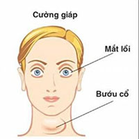 11 biến chứng suy tuyến giáp nguy hiểm khôn lường cần biết