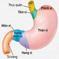 Viêm hang vị dạ dày: Nguyên nhân, triệu chứng và cách điều trị