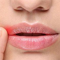 Phát hiện đột phá về virus bệnh tình dục phổ biến nhất thế giới