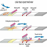 Que test HIV bị cắt sẽ làm sai lệch kết quả xét nghiệm