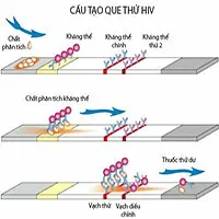 Que test HIV bị cắt sẽ làm sai lệch kết quả xét nghiệm