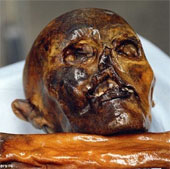 Lời nguyền của Otzi