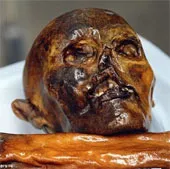 Lời nguyền của Otzi