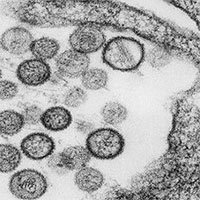 Những loại virus nguy hiểm trên Trái Đất