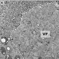 Phát hiện virus 