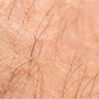 Phát triển thành công da từ tế bào gốc có thể được cấy ghép và mọc lông