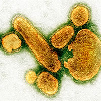 Điều gì xảy xa nếu một ngày tất cả virus biến mất?