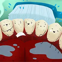 Điều gì xảy ra nếu bạn ngừng đánh răng?