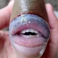 Cư dân mạng thích thú với con cá "sở hữu bờ môi căng mọng" y như con người