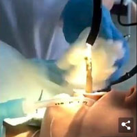 Kinh hãi cảnh kéo con rắn 1,2m từ cổ họng một phụ nữ Nga