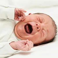 Vì sao trẻ sơ sinh bị đột quỵ?