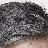 Phát hiện nguyên nhân "tại sao căng thẳng lại khiến tóc bạc"