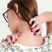 Căn bệnh khiến người mắc bị ám ảnh nhiễm ký sinh trùng