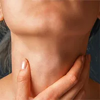 U nang thanh quản là gì?