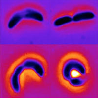 Vi khuẩn đã biết thay hình đổi dạng để tránh thuốc kháng sinh?