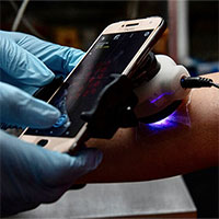 Băng dán cảm biến đổi màu khi phát hiện da hoại tử