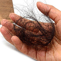 Tìm ra phương pháp mới để chống rụng tóc