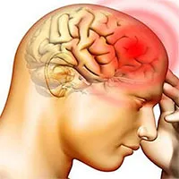Bệnh phù não: Nguyên nhân, triệu chứng và cách điều trị