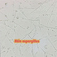 Vì sao ăn hạt hướng dương thường gây ngứa cổ và ho?