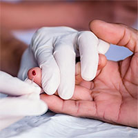 Triệu chứng nhiễm HIV qua từng giai đoạn