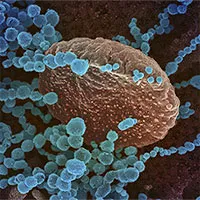 Sóng siêu âm có thể tiêu diệt virus SARS-CoV-2