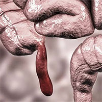 Điều gì xảy ra nếu con người không có ruột thừa?