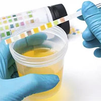 Nước tiểu có mùi lạ là dấu hiệu cảnh báo nhiều vấn đề sức khỏe mà bạn không nên coi thường