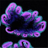 Vì sao kích cỡ não người lớn hơn tinh tinh, khỉ đột?