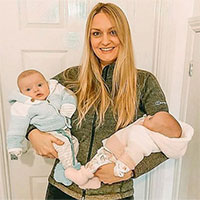 Cặp song sinh hiếm gặp, được mệnh danh là 