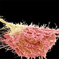 Tại sao một số loại thuốc điều trị ung thư không phát huy tác dụng?