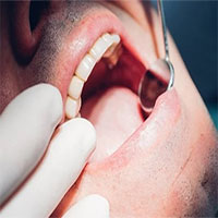 Vì sao răng ê buốt khi ăn uống đồ lạnh?