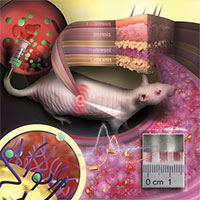 Cảm biến dưới da kiểm tra khả năng tiếp nhận thuốc