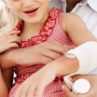 Cách chữa bỏng không để lại sẹo của lính cứu hỏa