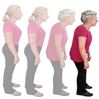 Tại sao chúng ta thấp đi khi về già?