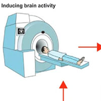 Công nghệ mới hứa hẹn khả năng xoá bỏ những ký ức tồi tệ đã qua