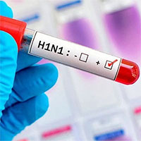 2 loại virus cúm gây tử vong ở người gần như đã tuyệt chủng