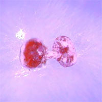 Các nhà khoa học phát triển nấm tiêu diệt ký sinh trùng ở ong