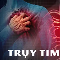 Trụy tim: Nguyên nhân, triệu chứng và cách điều trị