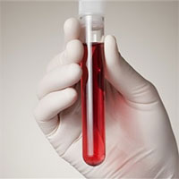 Phát triển thành công mũi điện tử phát hiện ung thư