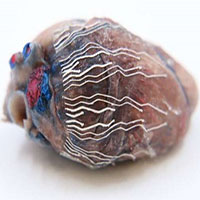 Mực sinh học giúp quá trình phẫu thuật an toàn hơn