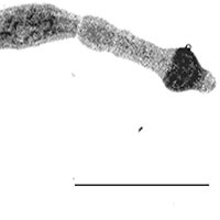 Một loại ký sinh trùng gây bệnh hiếm gặp có triệu chứng như ung thư mới xuất hiện tại Bắc Mỹ