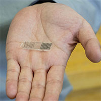 Miếng dán truyền điện giúp xương gãy mau lành