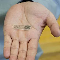 Miếng dán truyền điện giúp xương gãy mau lành