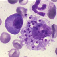 Nguy cơ ký sinh trùng “ăn thịt người” lan rộng ở Châu Mỹ trong tương lai