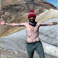 Nghị lực đáng nể của chàng trai không có dạ dày, ruột kết và túi mật