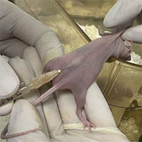 Các nhà khoa học tìm ra cách diệt khối u buồng trứng bằng virus sởi