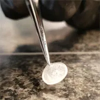 Phát minh thiết bị cấy ghép màng nhĩ in 3D
